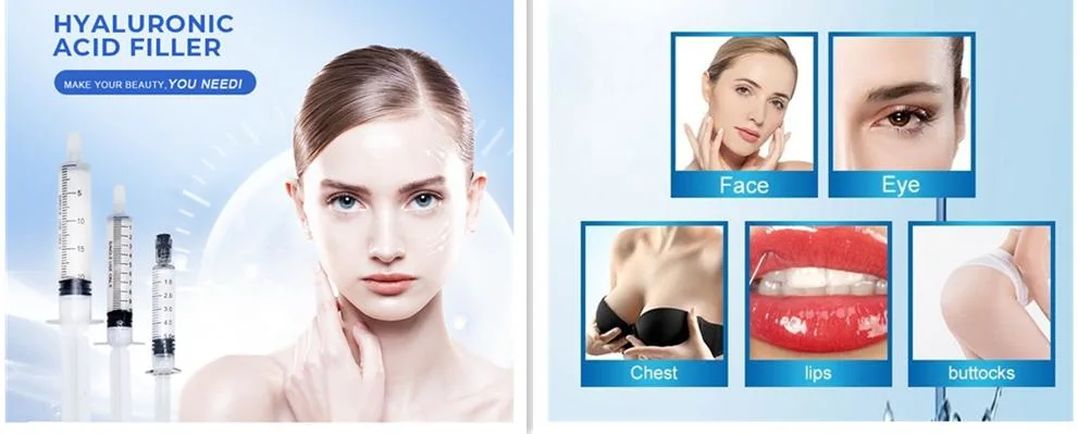 Cross-Linked Hyaluronic Acid Skin Care for Plastic Surgery Injectable Dermal Filler